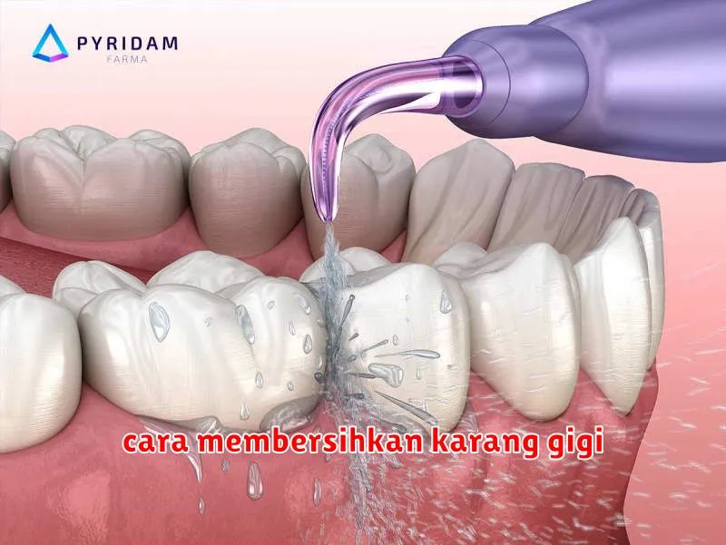 cara membersihkan karang gigi